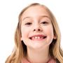 Чому потрібно лікувати молочні зуби дітям? (Новини компаній)