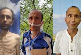 Дива не закінчуються: історія про колишнього безхатченка Євгена, який живе без шлунку