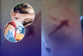 На Порика собака вкусила жінку. Що про випадок кажуть у притулку та що радять зоозахисники й МОЗ?