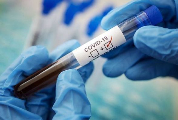 Від COVID-19 за добу одужало менше людей, ніж захворіло. Дані на 4 серпня : 04:08:2021 - Vimarsana News
