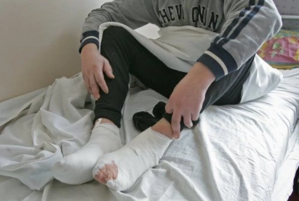 Є випадки ампутацій у п'яних і безхатьків: лікарі розповідають, хто найбільше страждає від обмороження