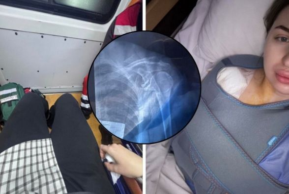 Відпочинок в чанах завершився операцією за 103 тисячі. Вінничанка послизнулась і вимагає компенсацію