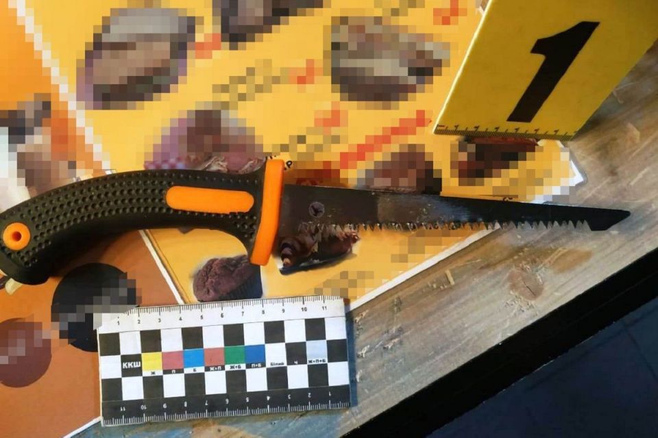 У Тульчині п'яний чоловік вдарив 18-річну баристу садовою пилкою по голові