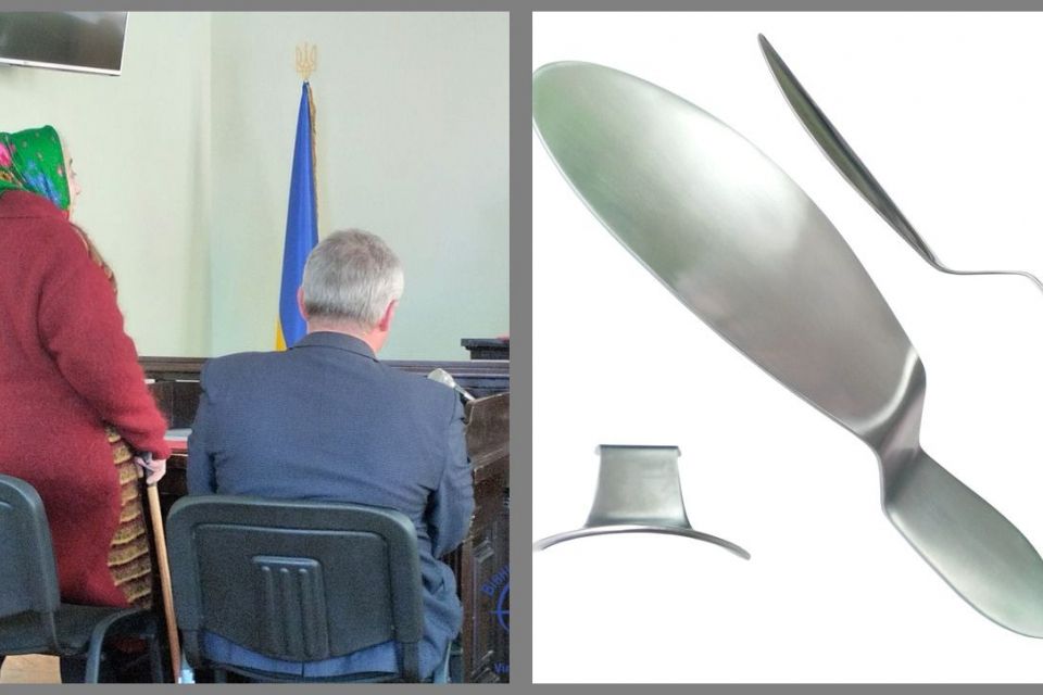 Хірургічний шпатель лікарі забули після операції в животі вінничанки... майже 20 років тому