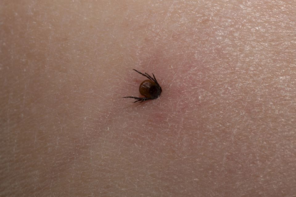 Кліщі взимку? На Вінниччині зафіксували перші випадки хвороби Лайма у 2026 році