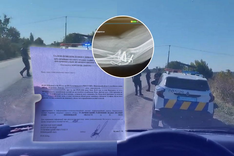 «Почав викручувати мені руки»: що водій розповів про конфлікт із патрульними та що каже поліція