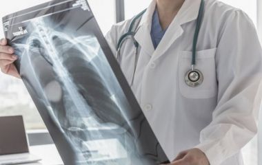 На Вінниччині зростає кількість випадків туберкульозу. За січень зареєстрували 48 пацієнтів