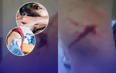 На Порика собака вкусила жінку. Що про випадок кажуть у притулку та що радять зоозахисники й МОЗ?