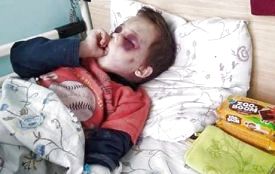 У побитті хлопчика з Козятинщини підозрюють мачуху