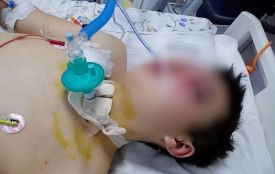 «Дивіться, нелюди, що ви наробили. Вас все одно знайдуть». В Іллінцях побили 17-річного юнака
