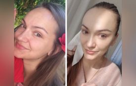 Фейсбілдінг VS ботокс? Про переваги гімнастики для обличчя розповідає тренер Вікторія Козак