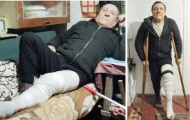 Автомобіль поліції охорони скалічив велосипедиста в Жмеринці. Ні допомоги, ні вибачень від людей у формі