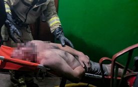 Пожежа на Стеценка почалась через куріння. Чоловіка винесли із задимленої квартири