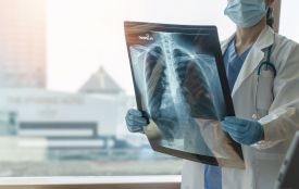 Туберкульоз вражає не лише легені: на Вінниччині зафіксували 67 складних форм