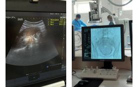 Вінницькі лікарі врятували 18-річну породіллю зі складною історією хвороб