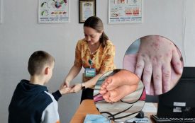 Симптоми як застуда, а наслідки серйозніші: що потрібно знати про Коксакі