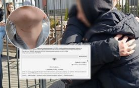 «Він приставив щось до горла, схоже на ножиці»: хлопець, який обрізав дівчатам коси, повернувся