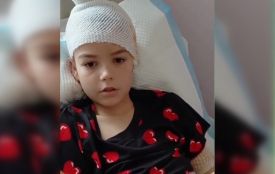 Кривавий напад у Лопатині: лікарі рятують дитину, на яку серед білого дня накинулася зграя псів