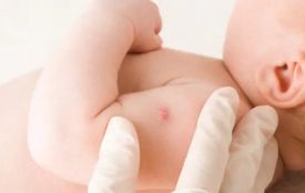 БЦЖ новонародженим робитимуть по-новому: лікарка розкрила деталі