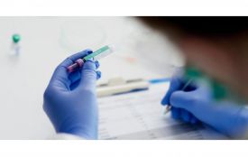 Аналізи при втомі та слабкості: що перевірити передусім (Новини компаній)