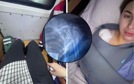 Відпочинок в чанах завершився операцією за 103 тисячі. Вінничанка послизнулась і вимагає компенсацію