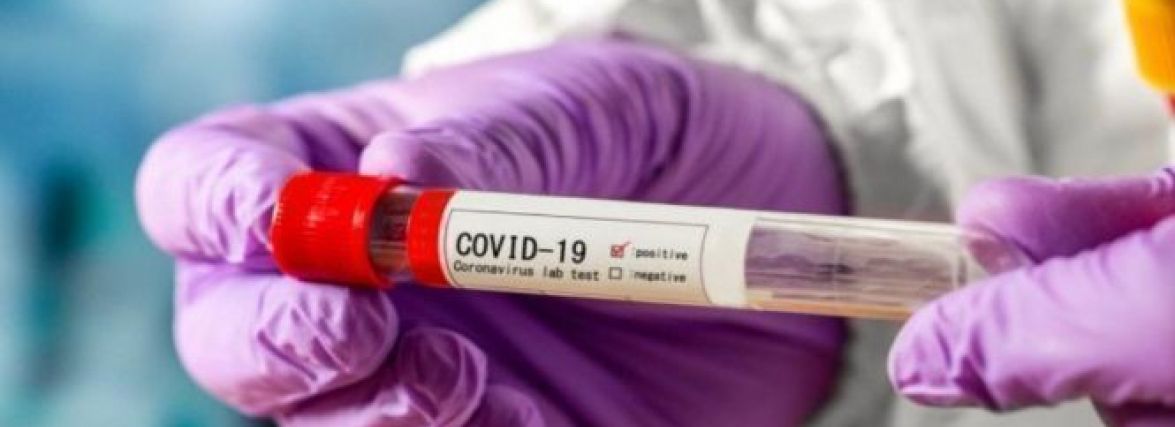 Дані про COVID: в Україні виявили 5 744 випадки. Скільки на Вінниччині?