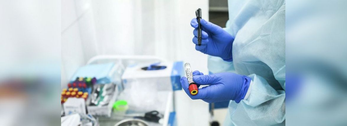 В області 22 смерті від корони та 558 нових хворих за добу. Дані по захворюваності