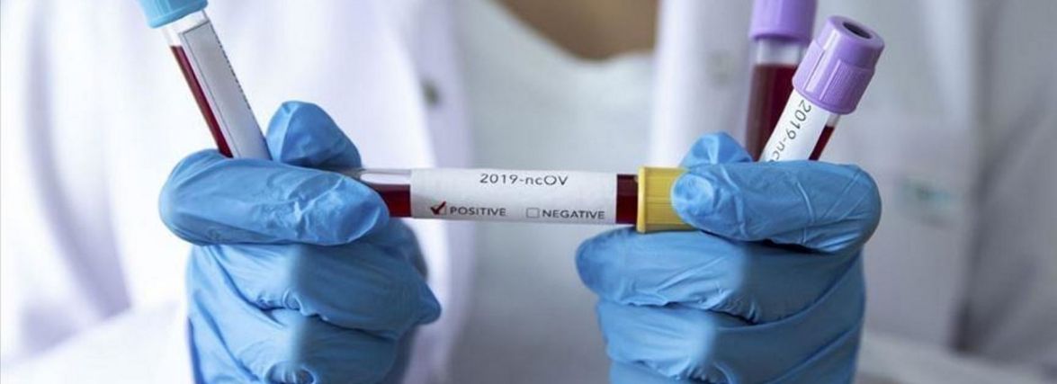 13 смертей від коронавірусу та 460 нових випадків: цифри по області