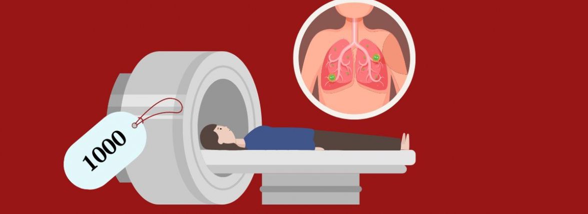 Комп'ютерна томографія легень: адреси та ціни на дослідження у Вінниці